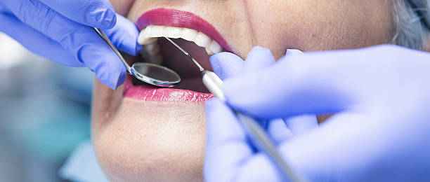 Best Emergency Root Canal Treatment in Mapleton, UT
